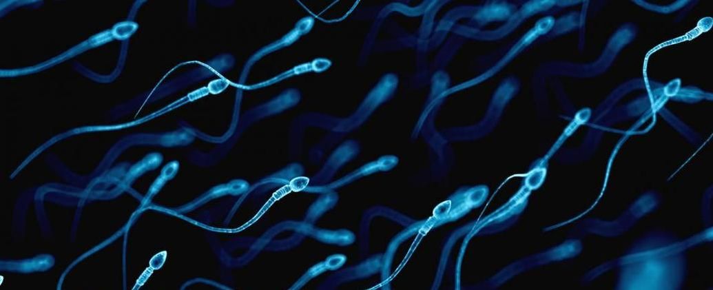 1035px x 421px - Different sperm colors explained - Dr Tony Bushati - Obstetrician &  Gynaecologist